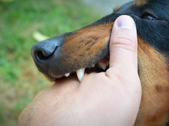 what should you do immediately after a dog bite